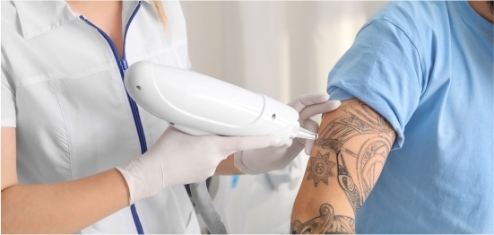 Where to get the best tattoo removal in Jaipur