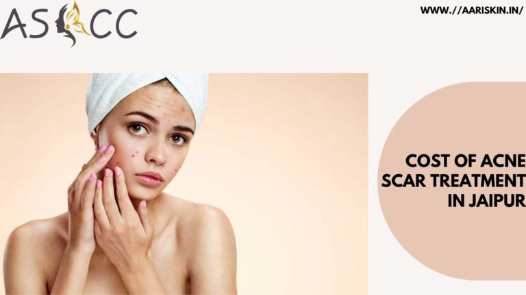Read more about the article Cost Of Acne Scar Treatment In Jaipur
