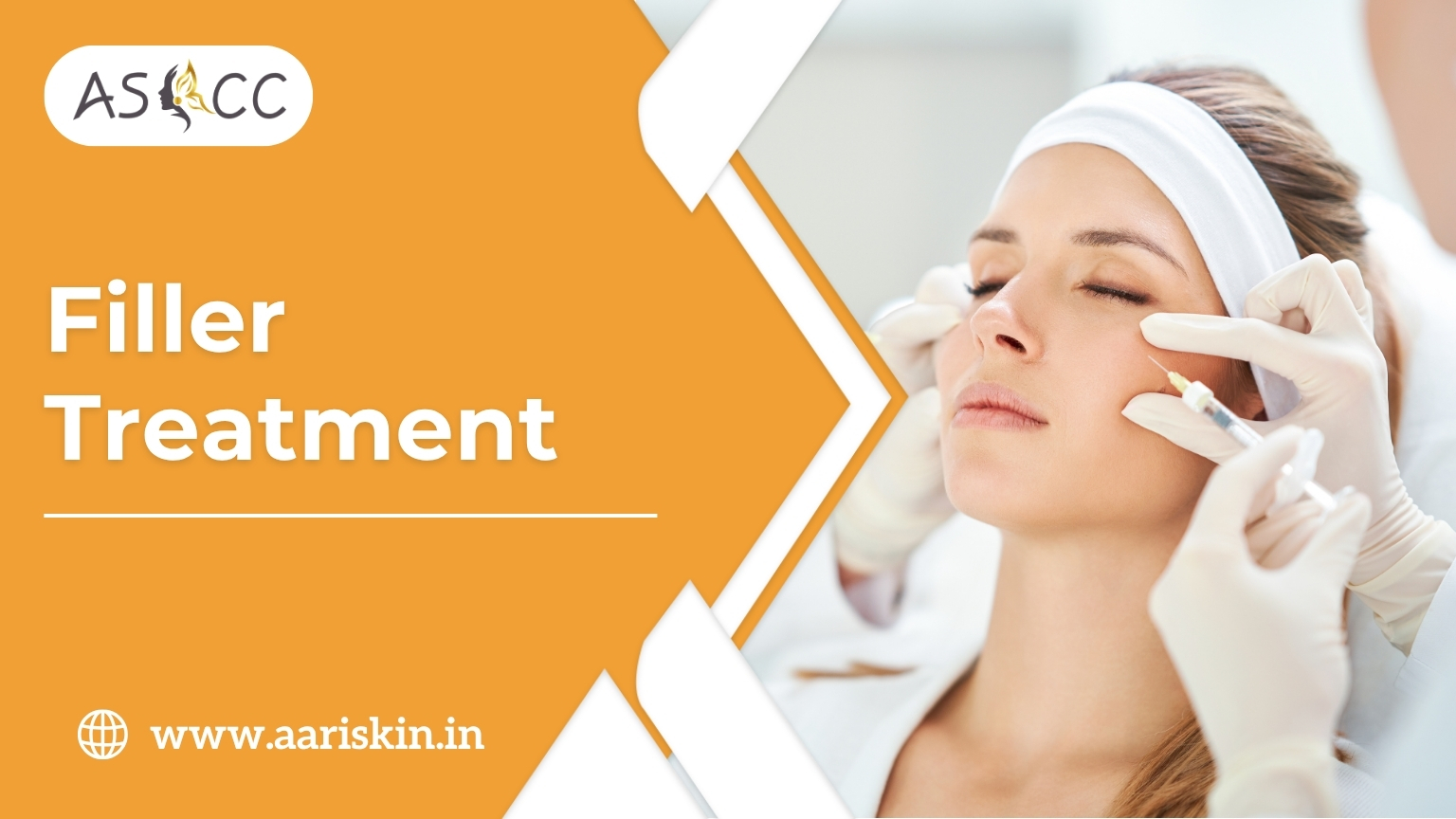 Read more about the article Filler Treatment