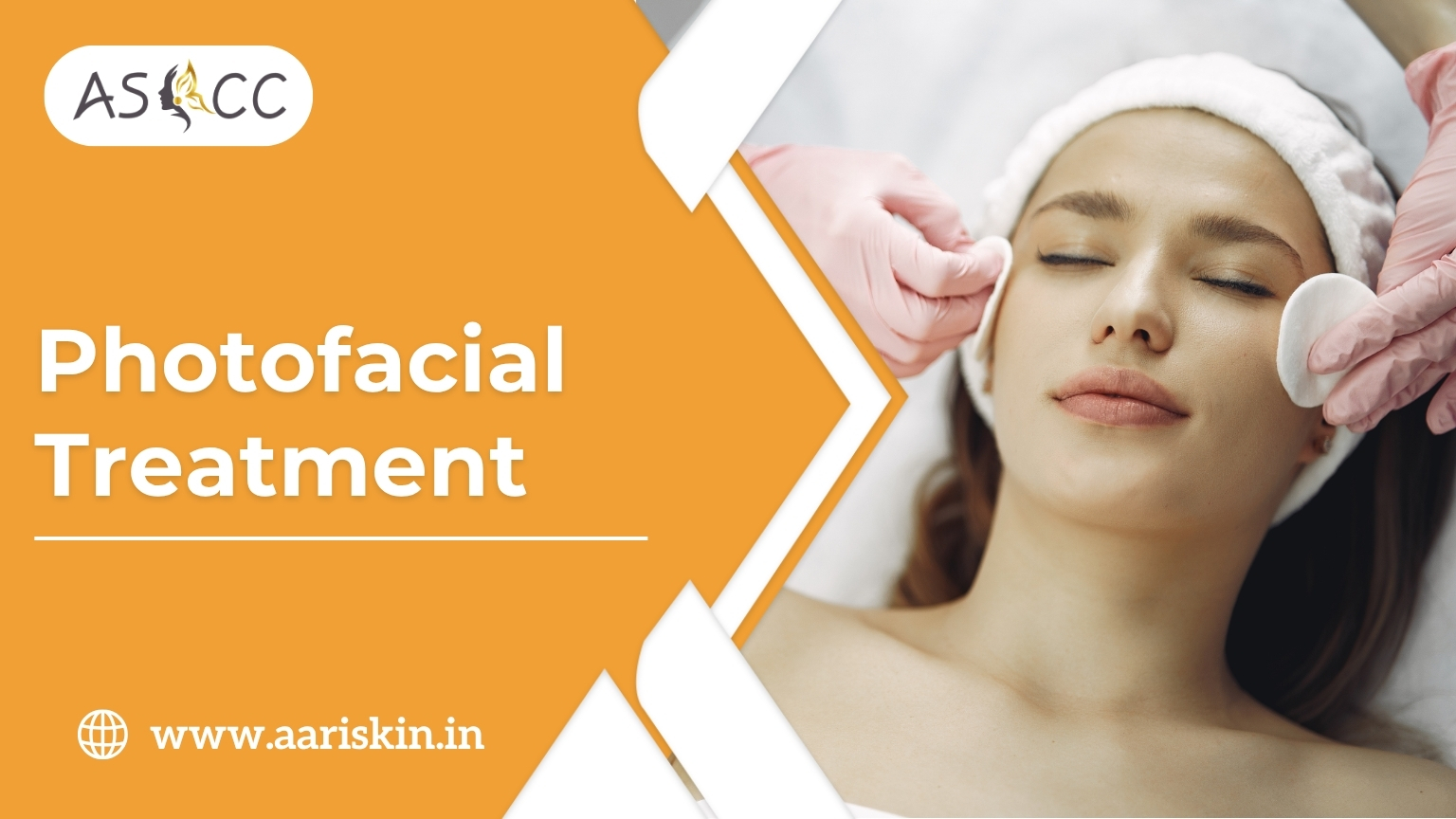 Read more about the article Photofacial Treatment