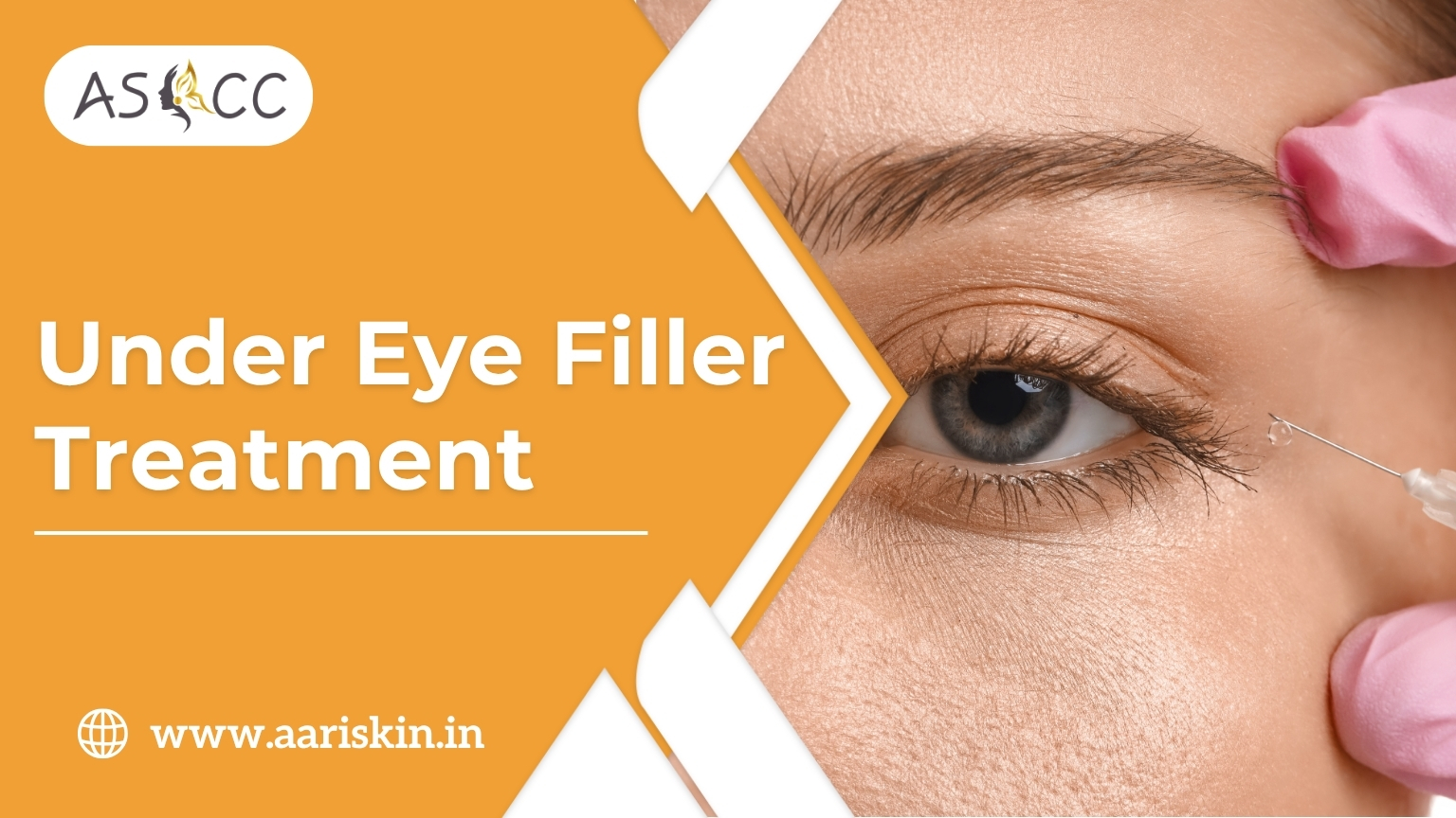 Read more about the article Under Eye Filler Treatment in Jaipur