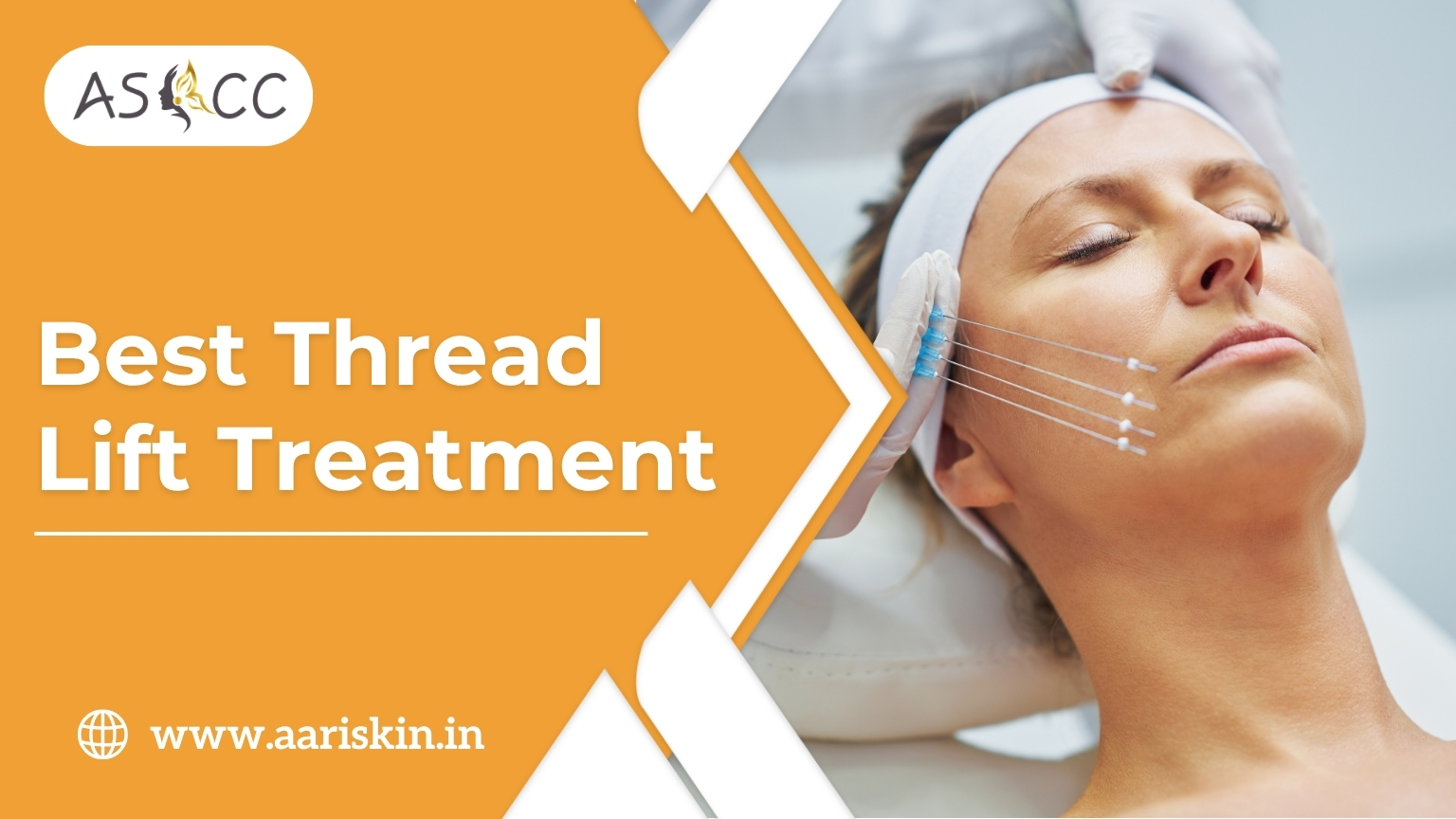 Read more about the article Thread Lift Treatment in Jaipur